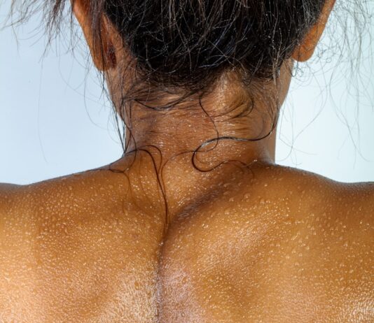 “아침에 손이 붓고 저릿해요”…초여름 수면자세와 부종의 관계 topless woman with brown hair